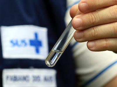 Fabiano dos Anjos durante acao de combate ao mosquito Aedes aegypti. Foto Sandro Araujo Agencia Saude DF 3 400x300 1