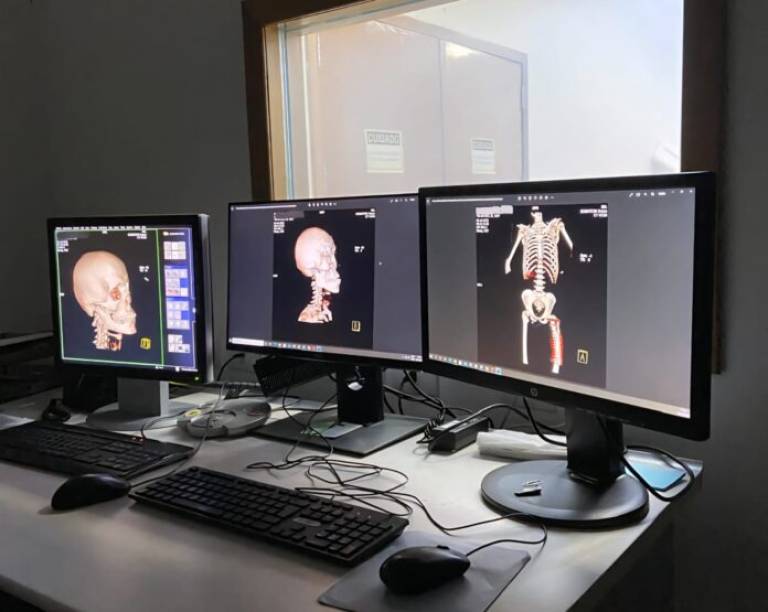 PCDF realiza treinamento em radiologia forense com uso de tomografia