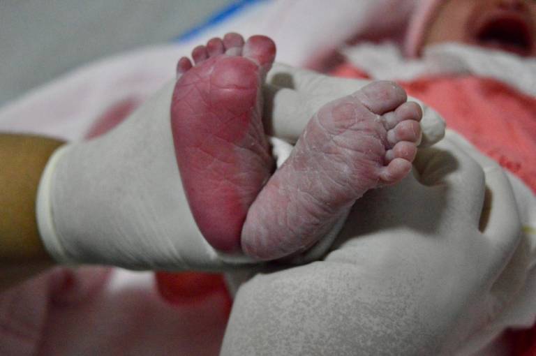 Hospital Estadual de Formosa ultrapassa mil partos humanizados e consolida referência regional em assistência materno-infantil