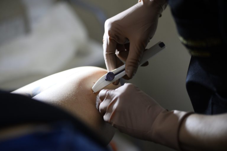 Implanon: novo método contraceptivo está disponível nas unidades básicas de saúde do DF